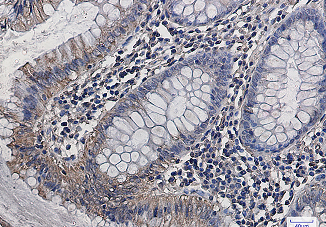 Aspartate Aminotransferase Rabbit mAb