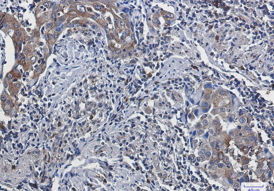 FACL4 Rabbit mAb