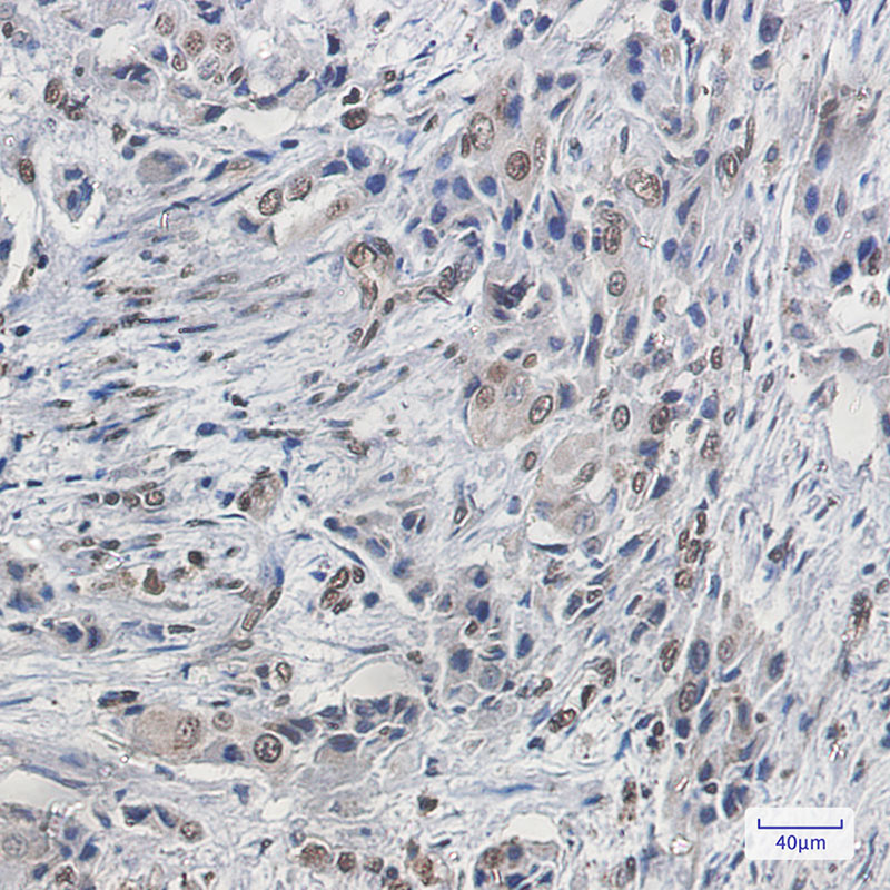 FBP1 Rabbit mAb