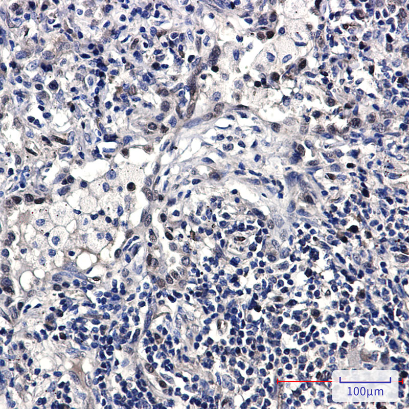 FDPS Rabbit mAb