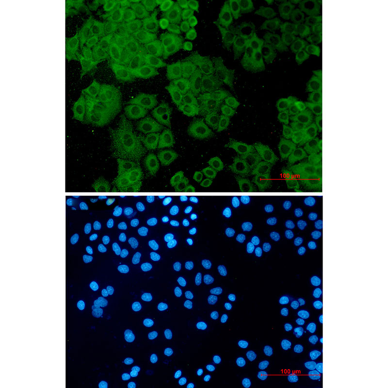 FH Rabbit mAb