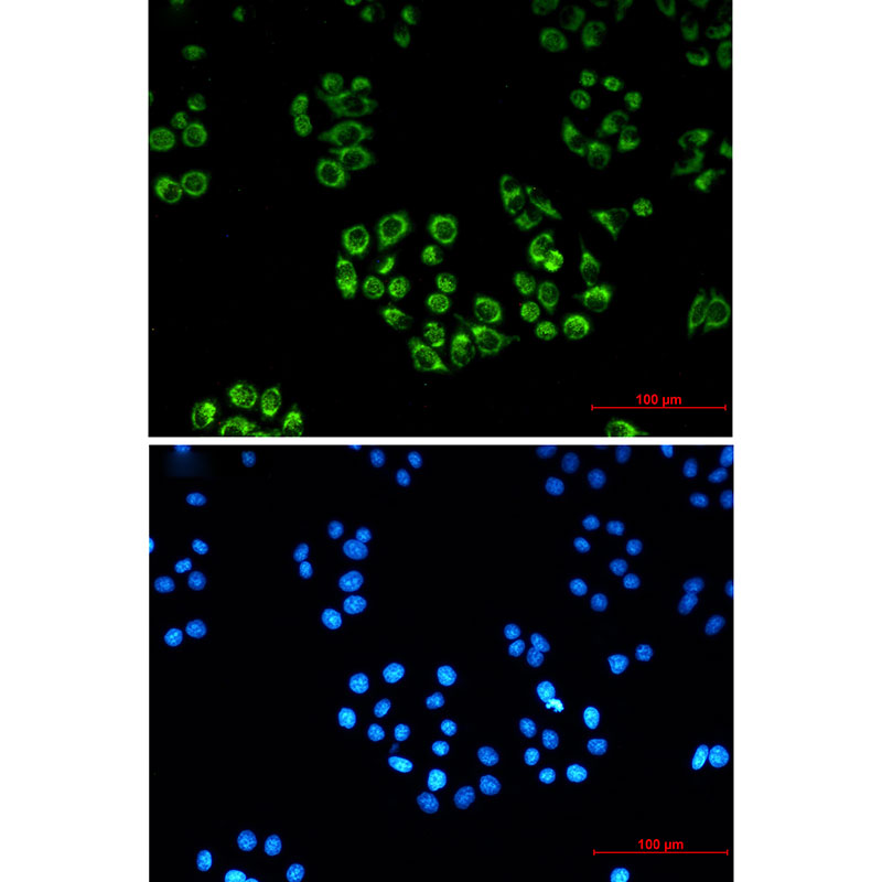 FH Rabbit mAb