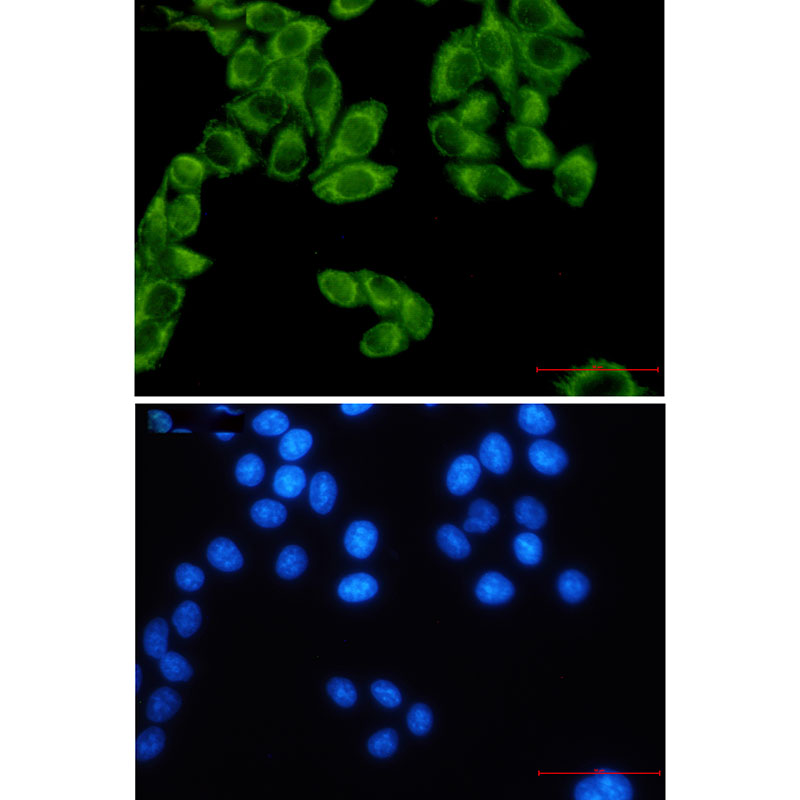 FH Rabbit mAb