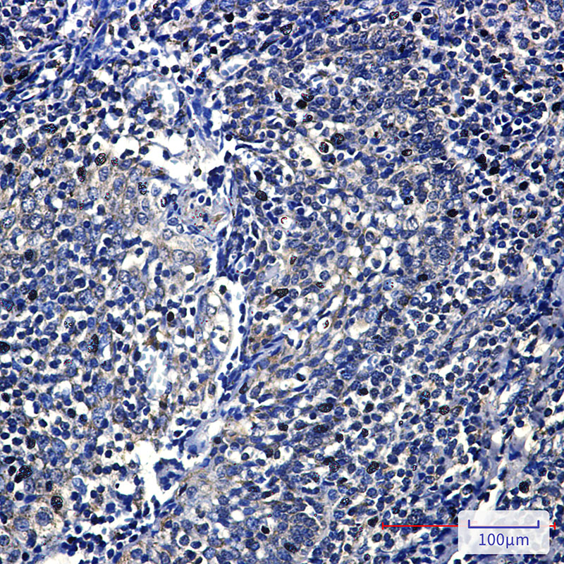 FH Rabbit mAb