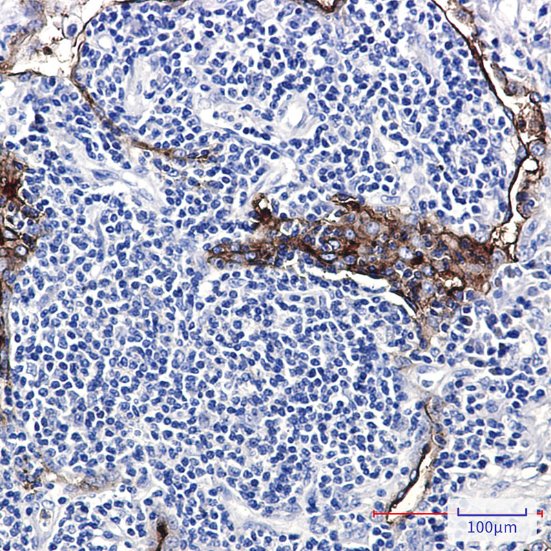 Folate Binding Protein Rabbit mAb