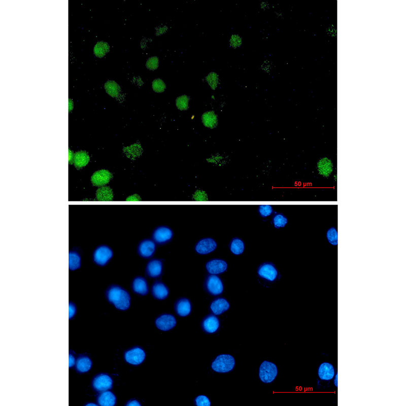 FOXA1 Rabbit mAb