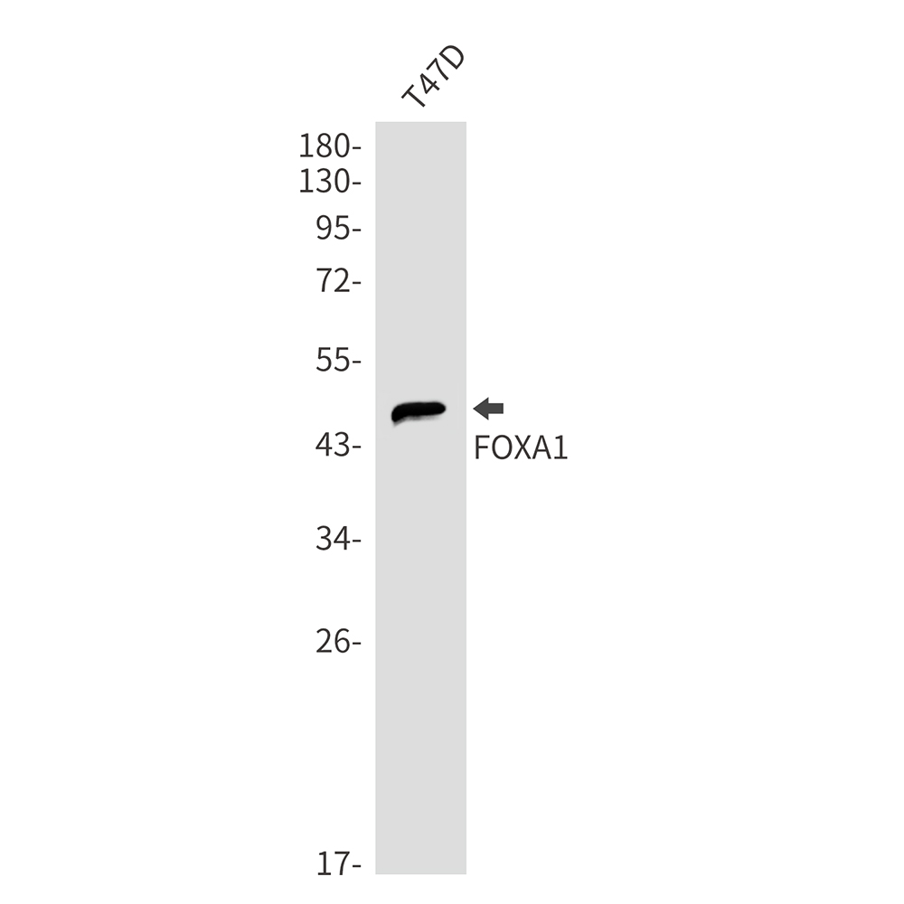 FOXA1 Rabbit mAb