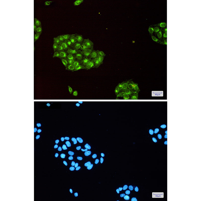 Fragilis Rabbit mAb