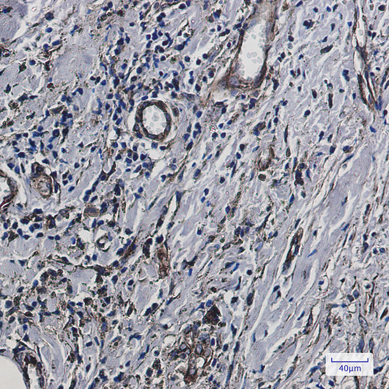 Fragilis Rabbit mAb