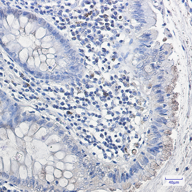 Galactosidase alpha Rabbit mAb