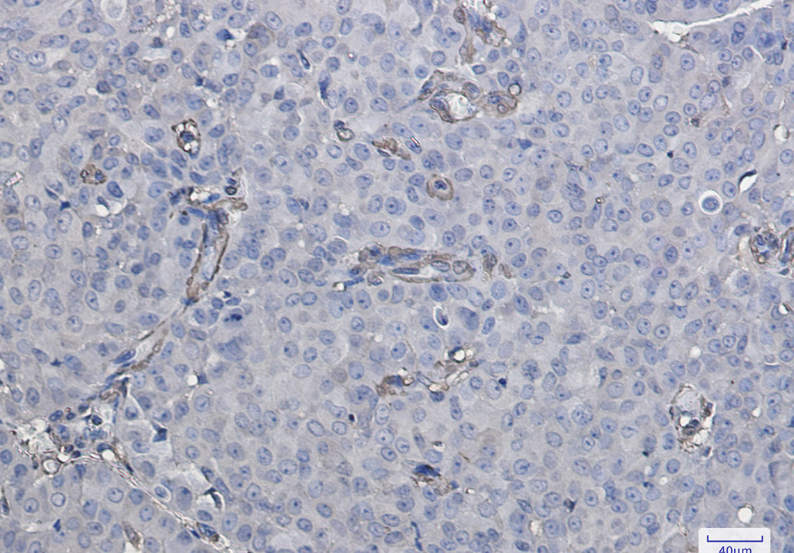 Galectin 1 Rabbit mAb