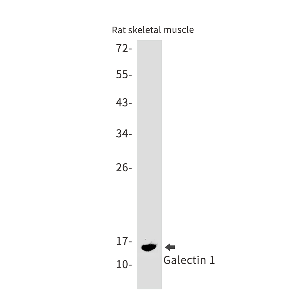 Galectin 1 Rabbit mAb