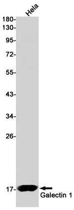 Galectin 1 Rabbit mAb