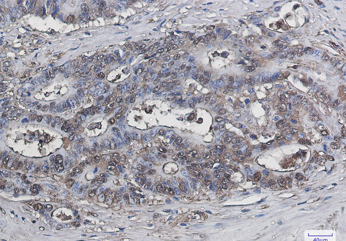 Galectin 3 Rabbit mAb