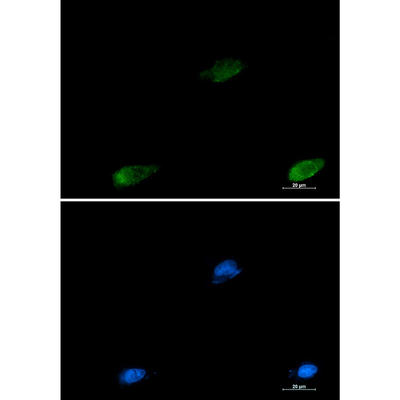 Galectin 3 Rabbit mAb