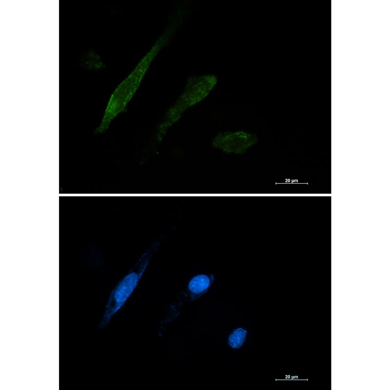 Galectin 3 Rabbit mAb