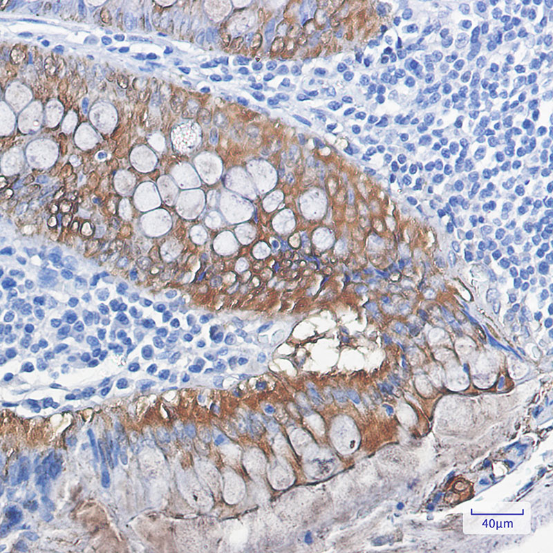 Galectin 3 Rabbit mAb