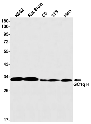 GC1q R Rabbit mAb