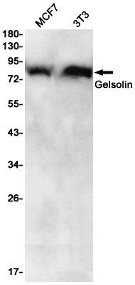 Gelsolin Rabbit mAb