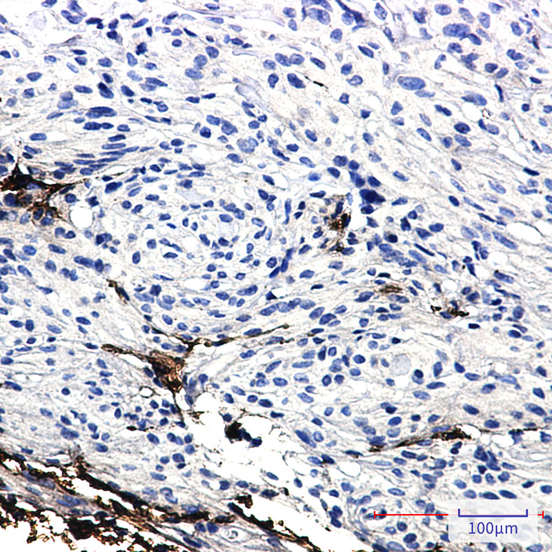 GFAP Rabbit mAb