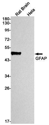 GFAP Rabbit mAb