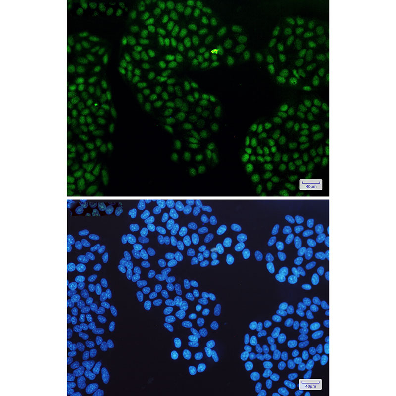 Glucocorticoid Receptor Rabbit mAb