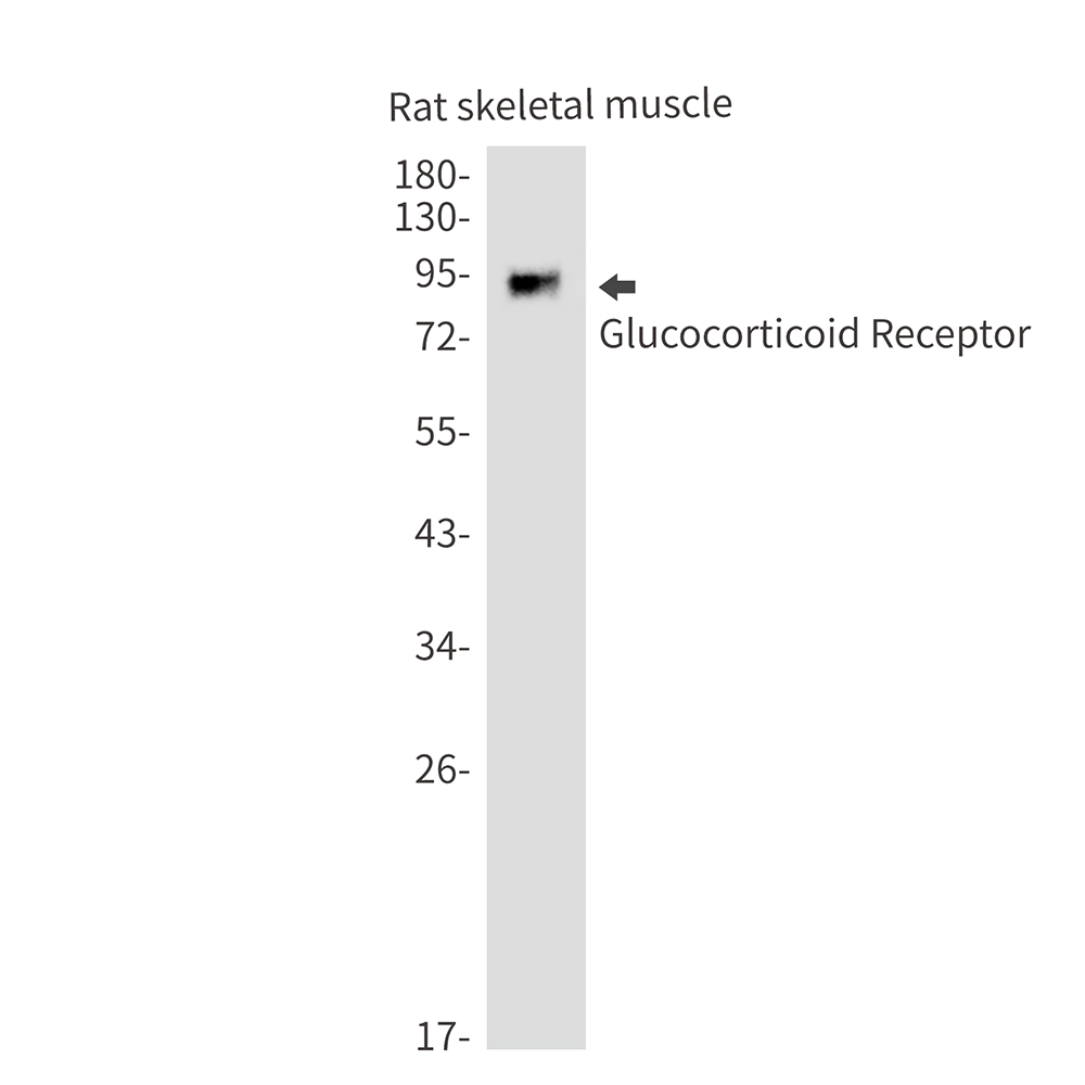 Glucocorticoid Receptor Rabbit mAb