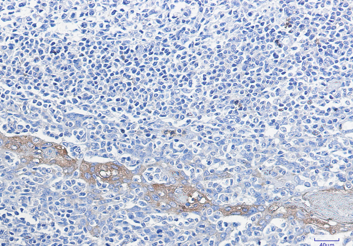 Glucose 6 Phosphate Dehydrogenase Rabbit mAb