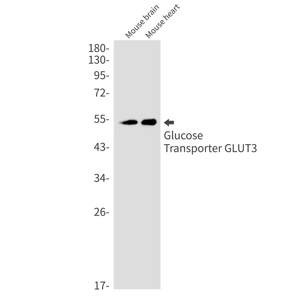 Glucose Transporter GLUT3 Rabbit mAb