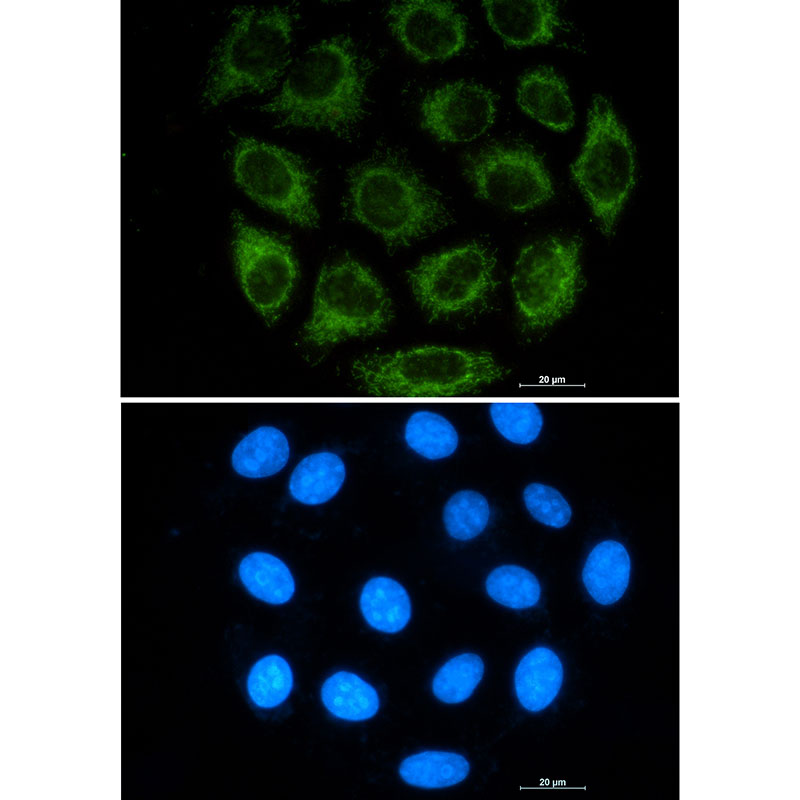 Glutaminase Rabbit mAb