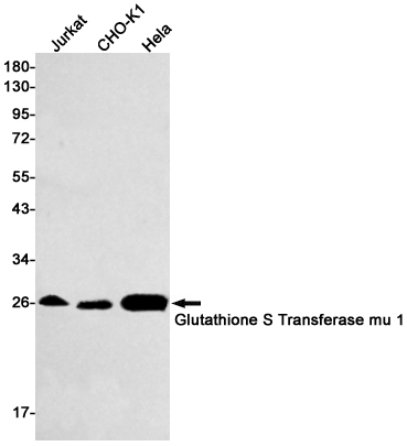 Glutathione S Transferase mu 1 Rabbit mAb