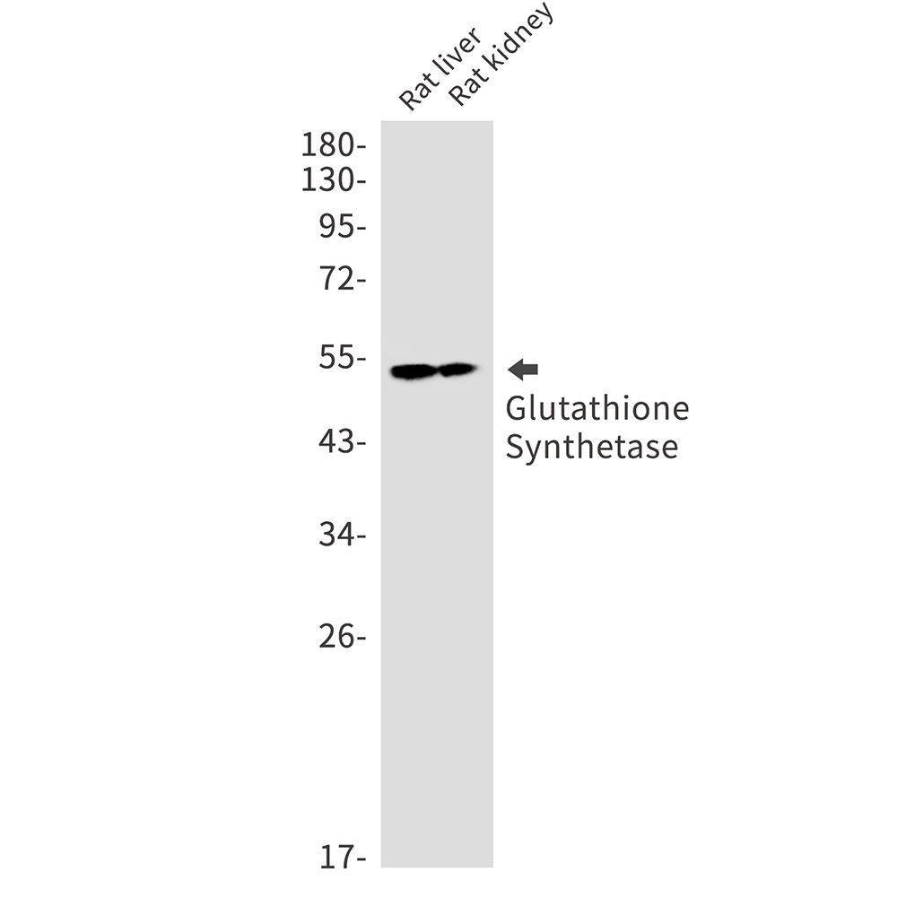 Glutathione Synthetase Rabbit mAb