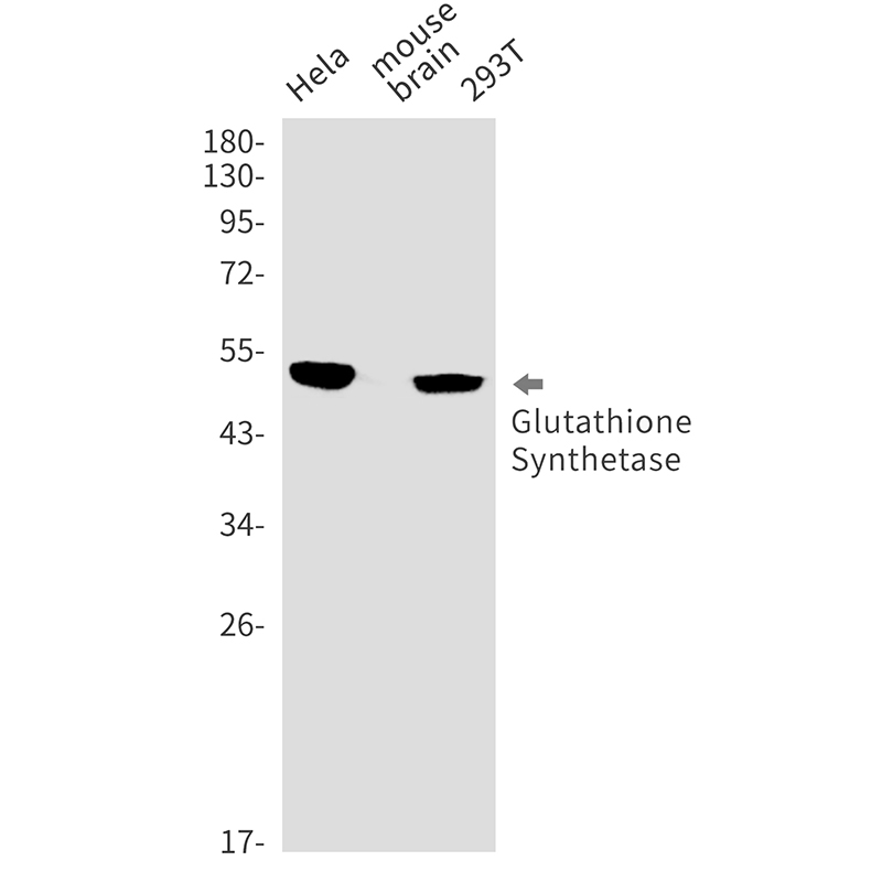 Glutathione Synthetase Rabbit mAb