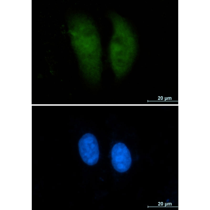 GST3 Rabbit mAb