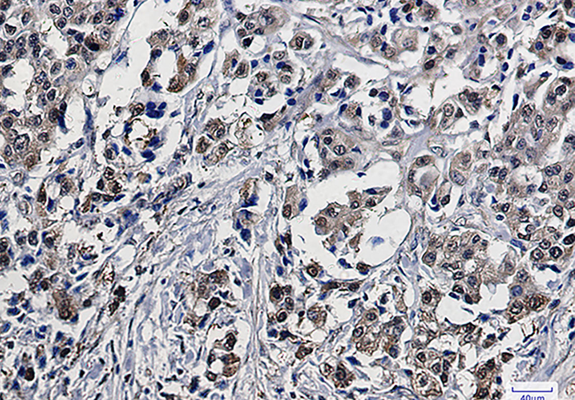 GST3 Rabbit mAb