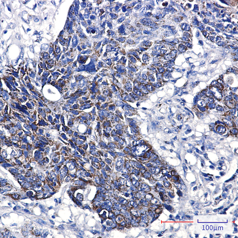 GST3 Rabbit mAb