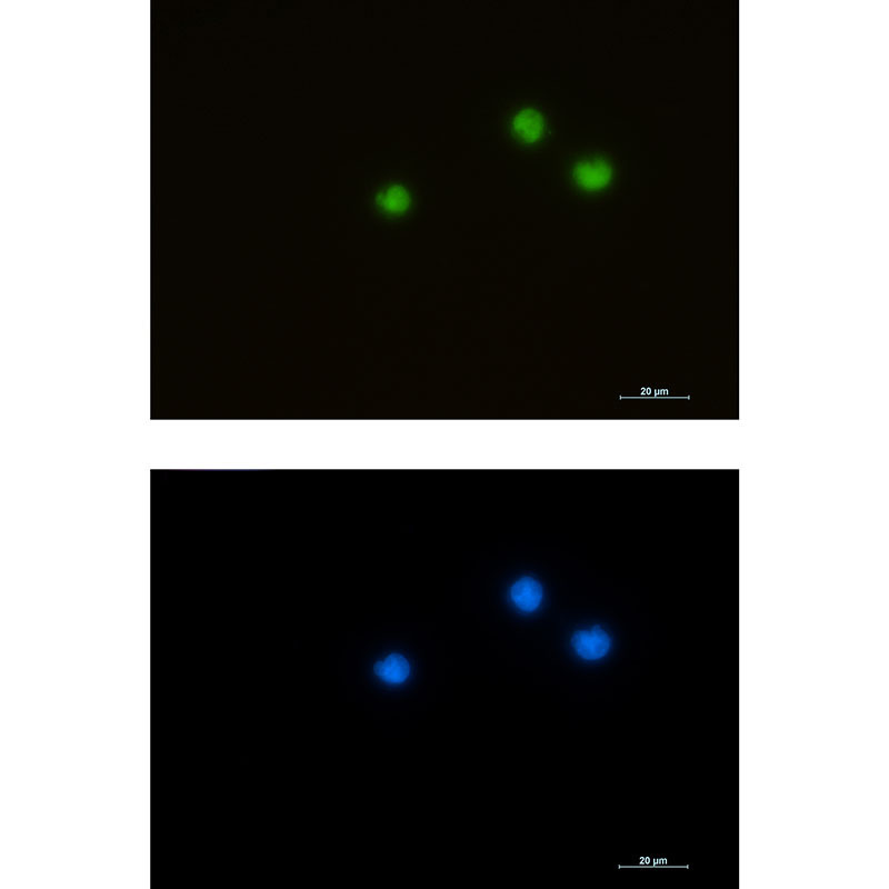 HDAC1 Rabbit mAb