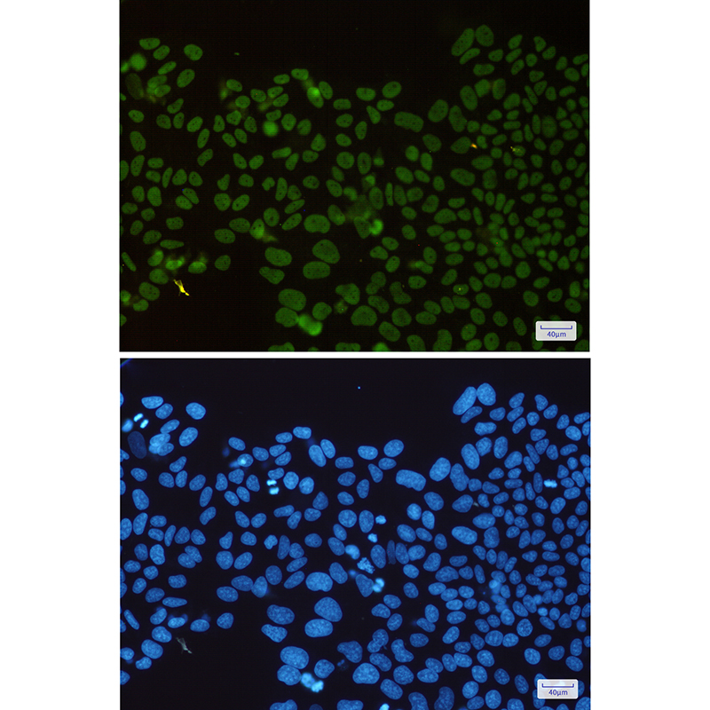 HDAC2 Rabbit mAb