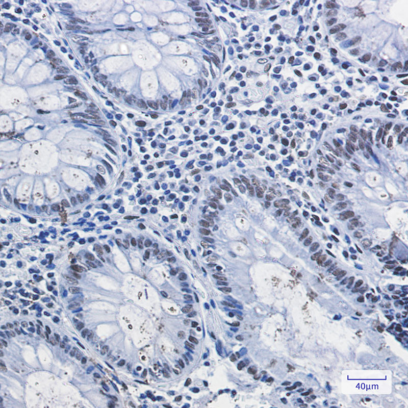 HDAC2 Rabbit mAb