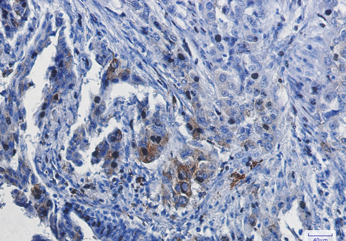 Heme Oxygenase 1 Rabbit mAb