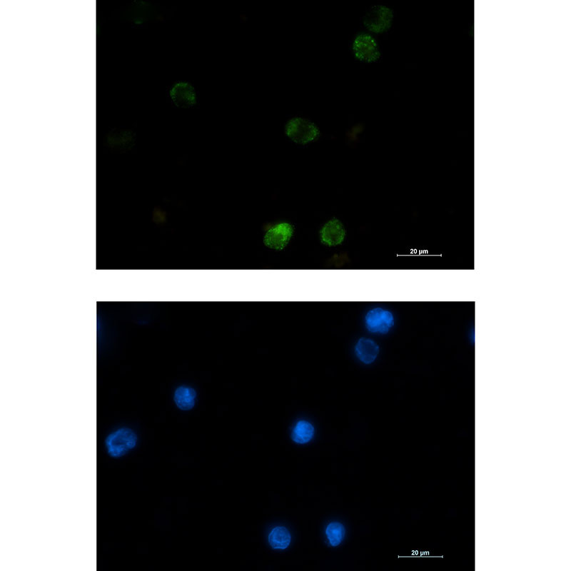 Hexokinase I Rabbit mAb