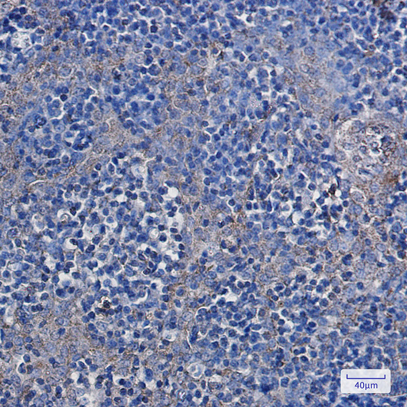 Hexokinase I Rabbit mAb