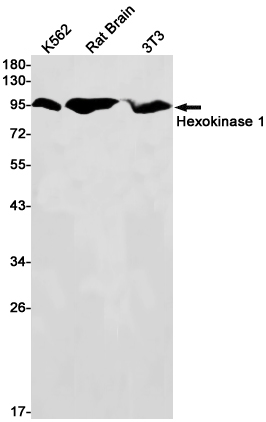 Hexokinase I Rabbit mAb