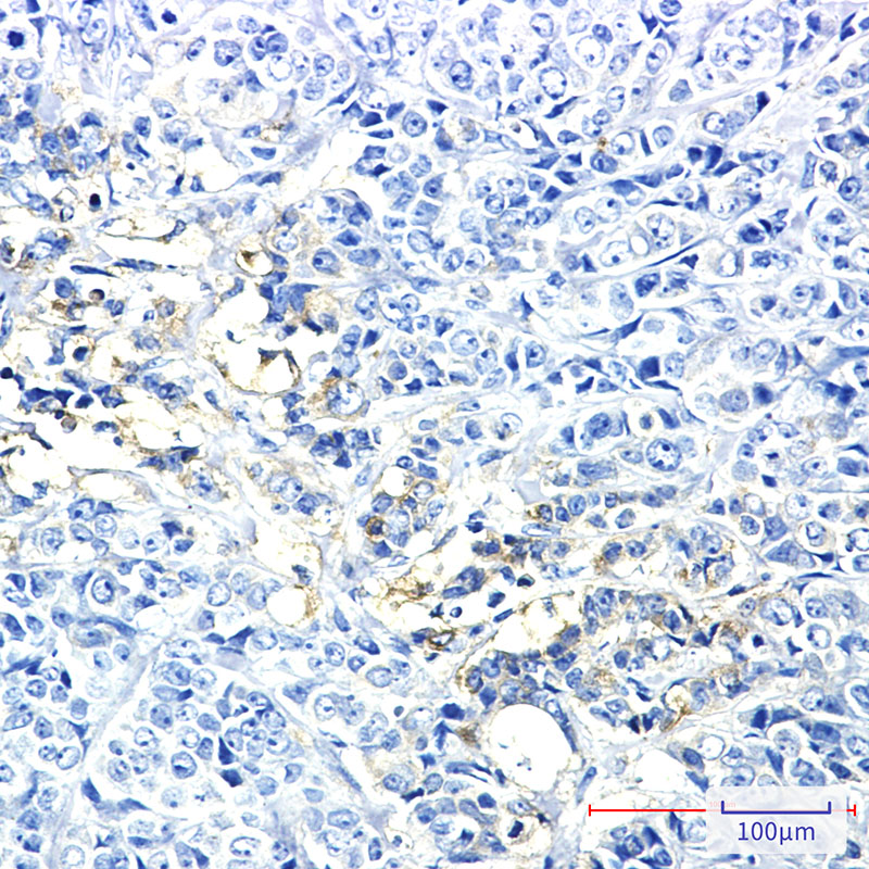 Hexokinase II Rabbit mAb