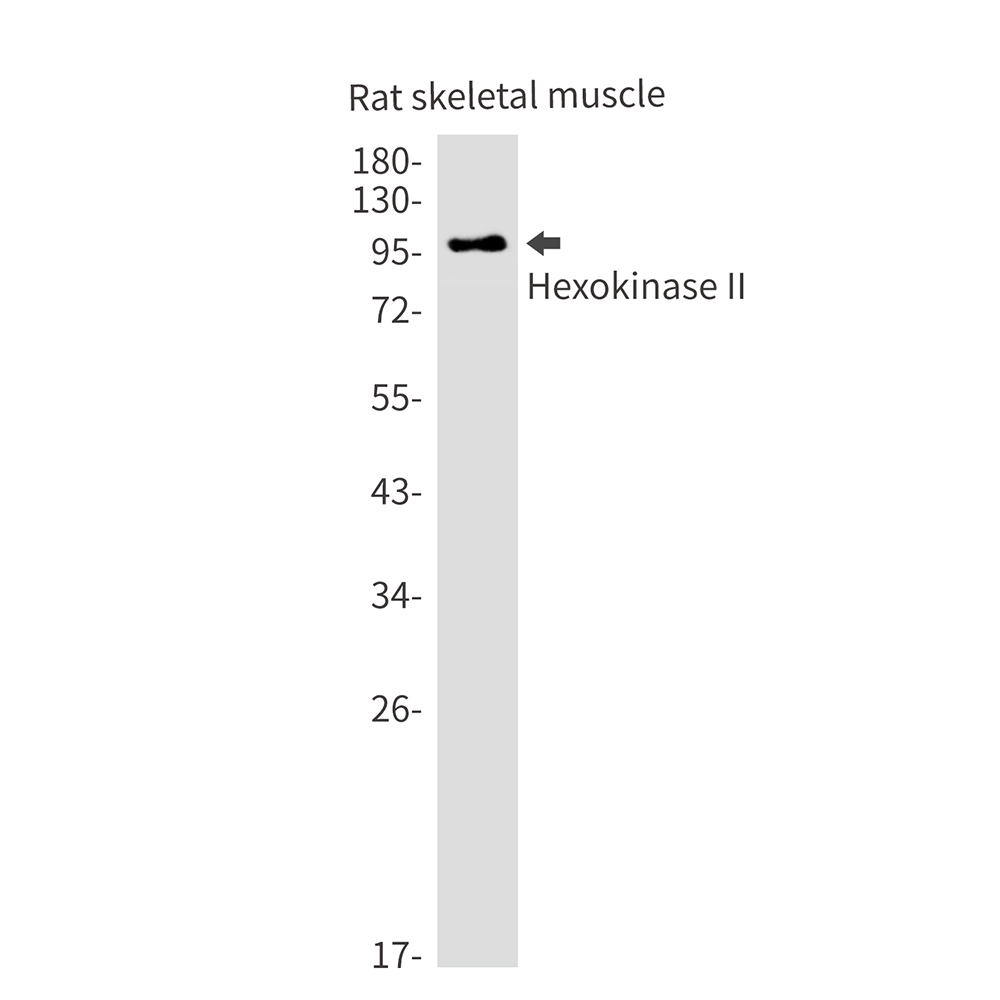 Hexokinase II Rabbit mAb