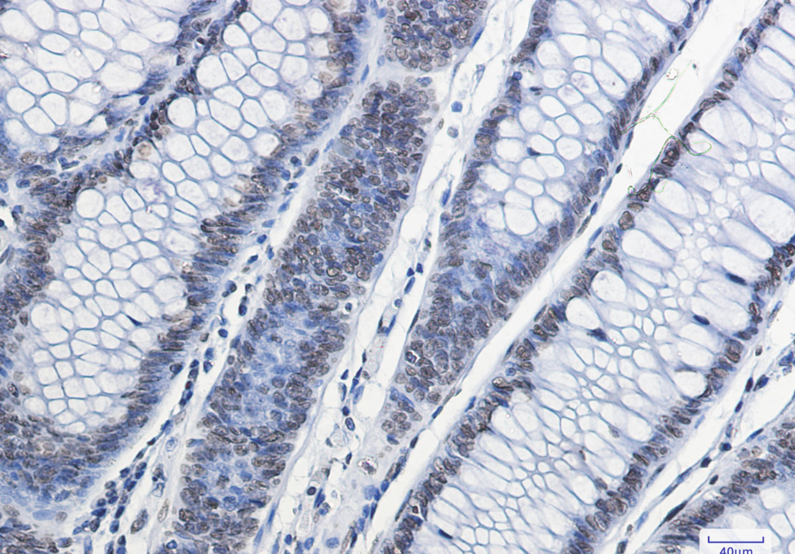 Histone H2A.X Rabbit mAb