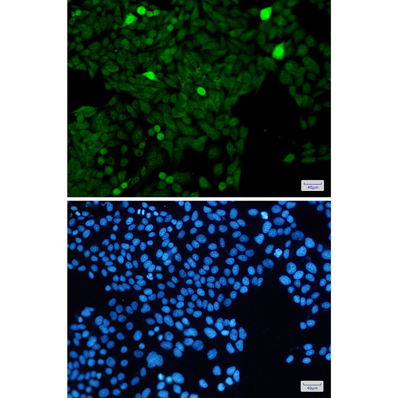 Phospho-Histone H3 (Ser28) Rabbit mAb