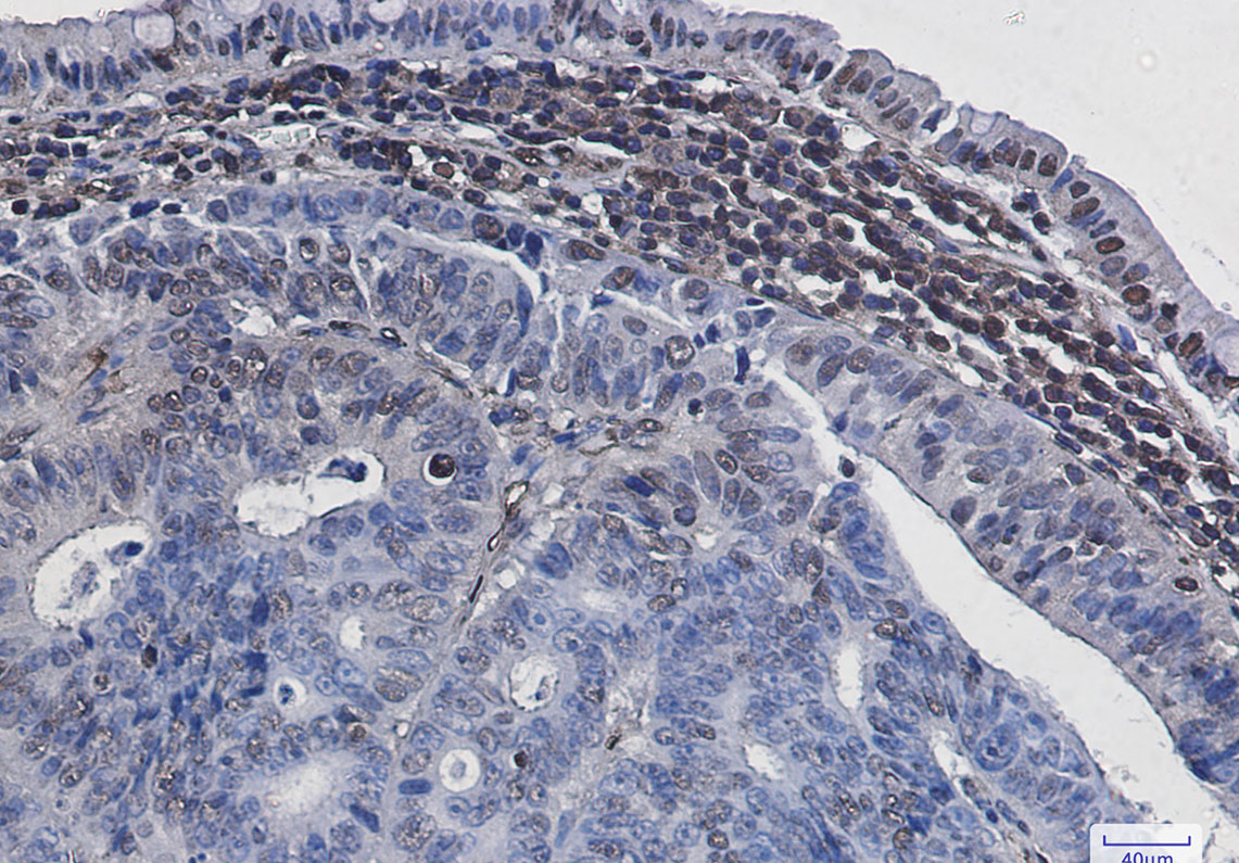 Phospho-Histone H3 (Ser28) Rabbit mAb