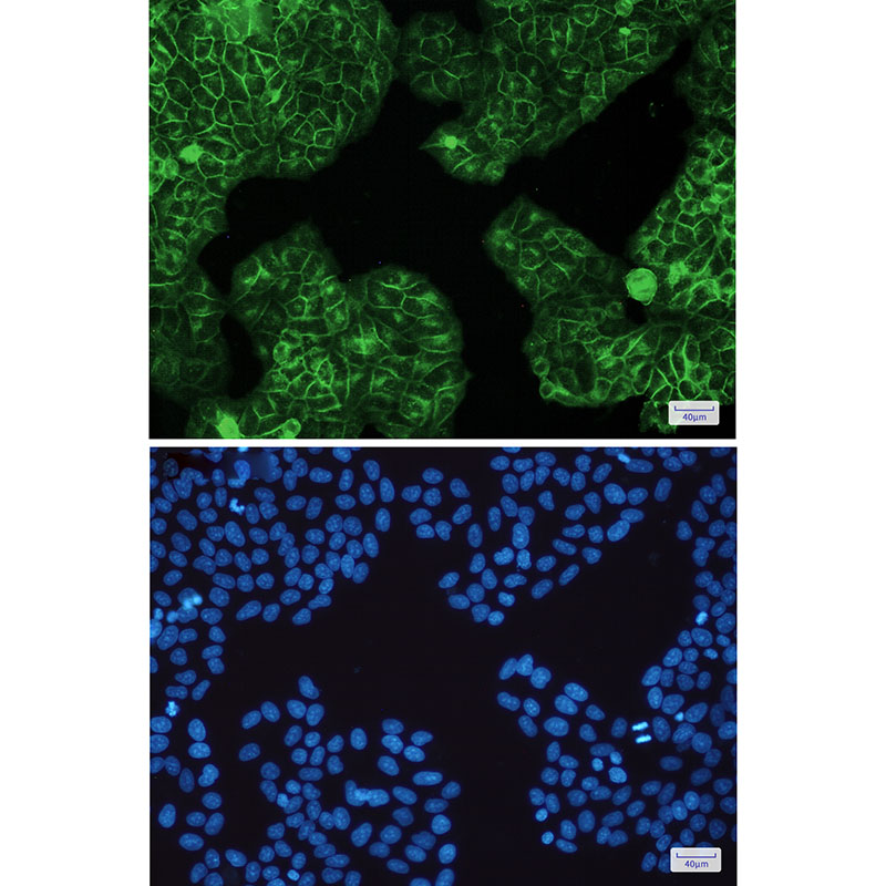 HLA A Rabbit mAb