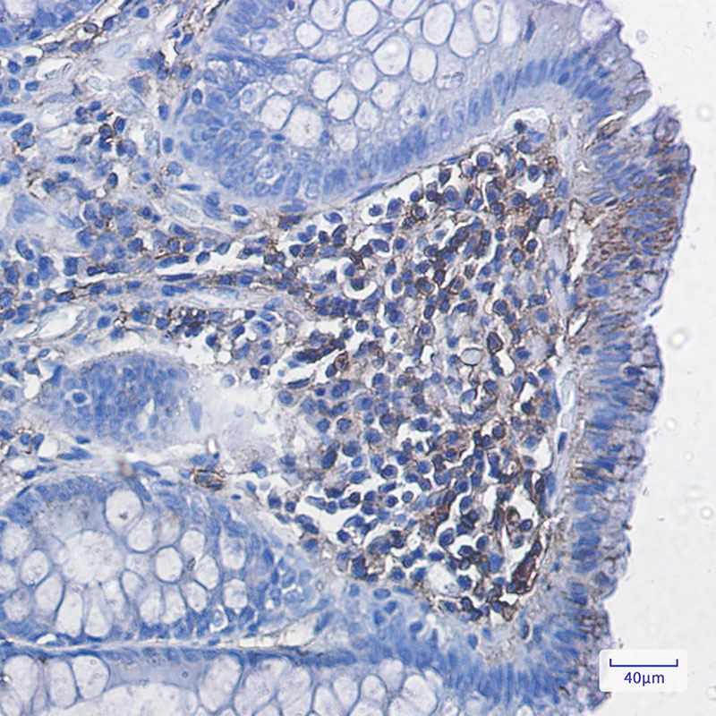 HLA A Rabbit mAb